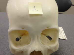 Point 1 on the skull labels the Frontal Bone which is viewed from the anterior (front) part of the skull. Point 1 on the skull labels the Frontal Bone which is viewed from the anterior (front) part of the skull.