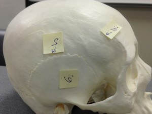 Point 4 points to the temporal line which is viewed from the lateral side of the skull. Point 5 is the squamosal suture that is also seen from the lateral side of the skull. Point 6 is the temporal bone that is viewed from the lateral side of the skull. Point 4 points to the temporal line which is viewed from the lateral side of the skull. Point 5 is the squamosal suture that is also seen from the lateral side of the skull. Point 6 is the temporal bone that is viewed from the lateral side of the skull.