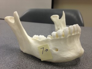 Point 7 points to the mental foramen which is where the blood vessal enters the skull's jaw which is seen on the skull's anterior (front) position but is inferior (below) the skull's teeth. Point 7 points to the mental foramen which is where the blood vessal enters the skull's jaw which is seen on the skull's anterior (front) position but is inferior (below) the skull's teeth.