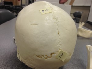 Point 8 points to the sagittal suture that separates the skull into right and left from the superior (top) view of the skull while Point 9 at the skull's posteiror (back) points to the occipital bone. Point 8 points to the sagittal suture that separates the skull into right and left from the superior (top) view of the skull while Point 9 at the skull's posteiror (back) points to the occipital bone.