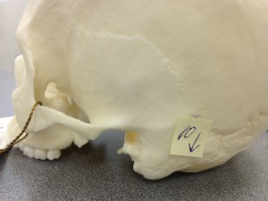 Point 10 is the mastoid process that is viewed from the skull's lateral (furthest part from the middle) position. Point 10 is the mastoid process that is viewed from the skull's lateral (furthest part from the middle) position.